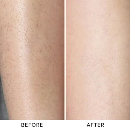 GlowBikini™ 2‑in‑1 Trimmer